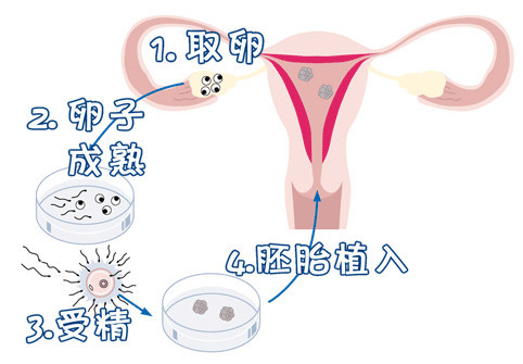 严重少弱精